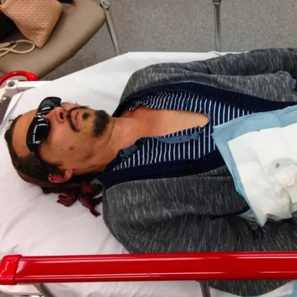 安柏赫德一暴怒竟削掉強尼戴普手指，證據音檔再曝光「我找不到手指」宛如驚悚片！