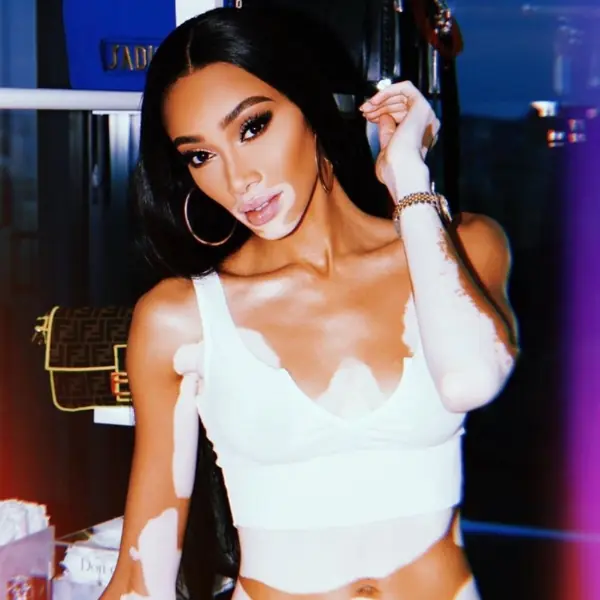 Winnie Harlow、Adut Akech Bior ...  5 位事業開外掛的「黑人模特兒」，私服穿搭也超有料！