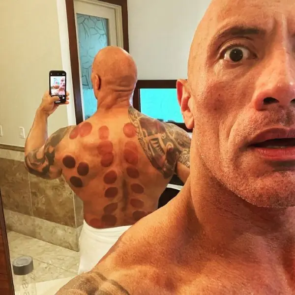 巨石強森第一次體驗「拔罐」，好萊塢最強肌肉猛男被一大片黑青嚇到！