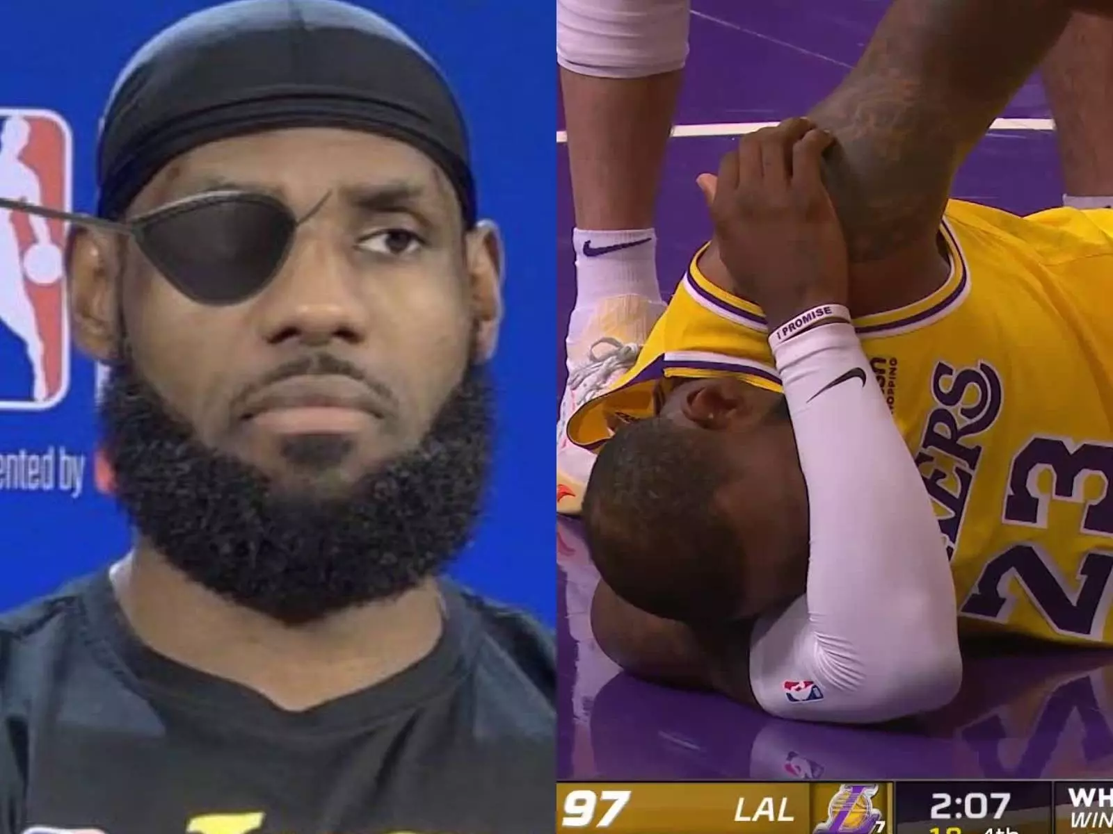 NBA／就是要贏！LeBron James 今日出戰勇士被「插眼」倒地不起，賽後表示：就算戴海盜眼罩也會出戰
