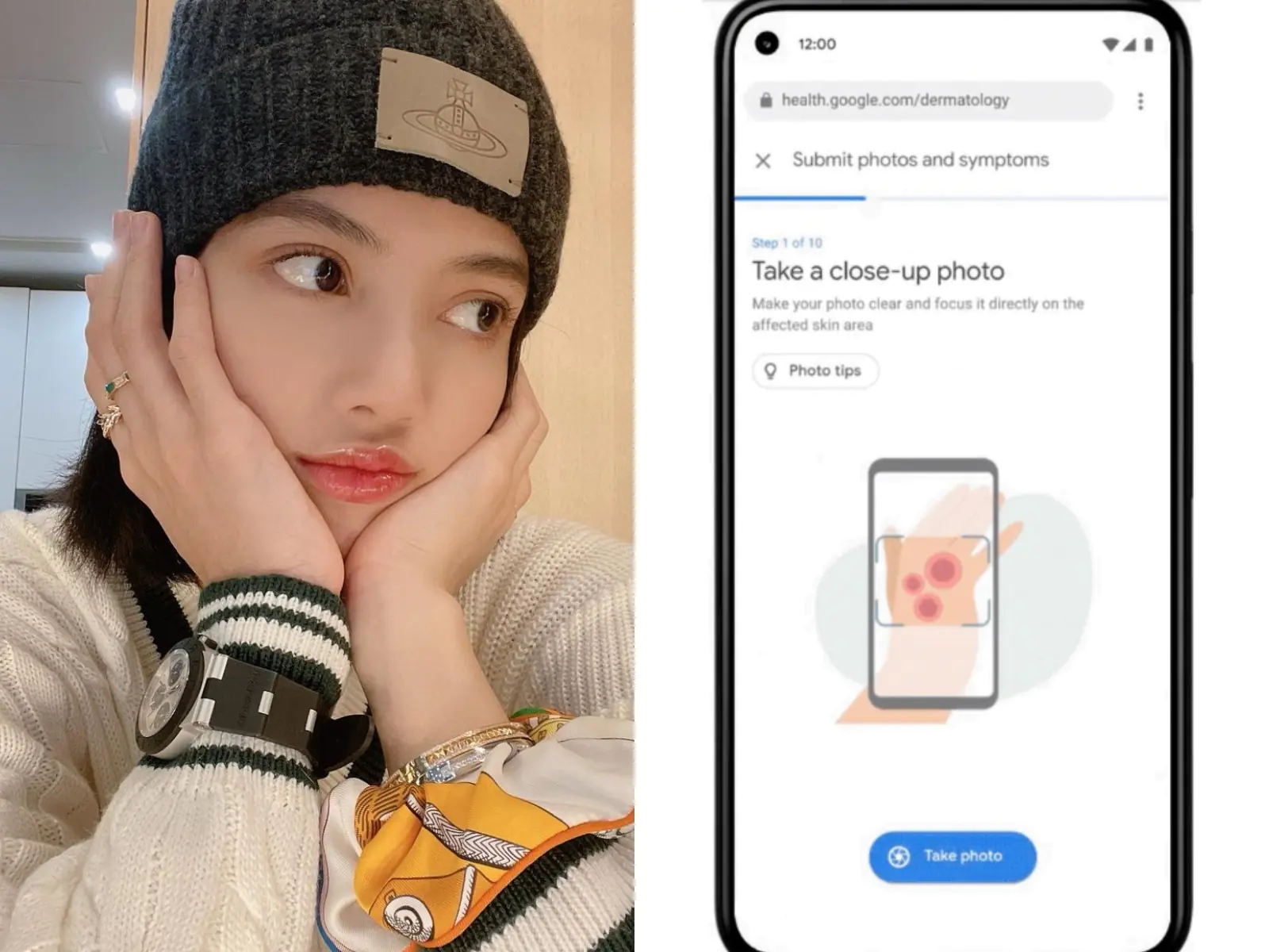 Google 推出「AI 肌膚檢測工具」：待在家就可以看皮膚科！