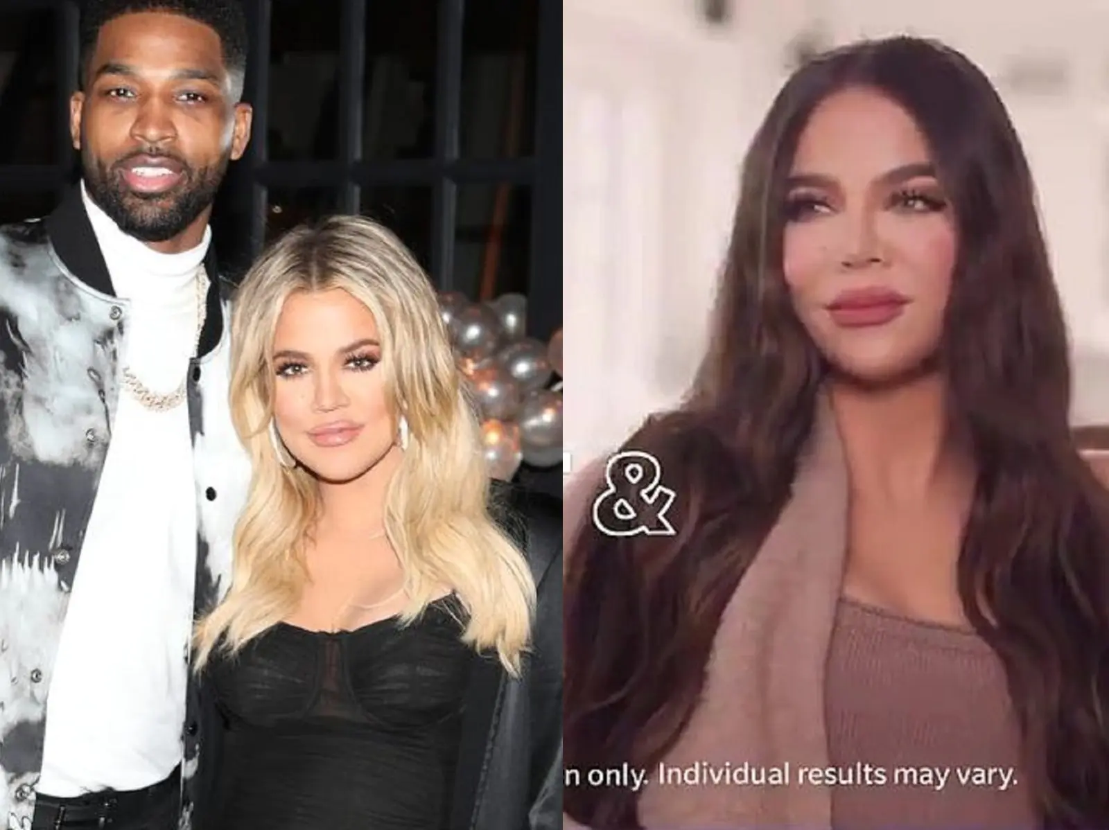 醫美到連媽都認不得？Khloe Kardashian 最新宣傳照，被網友吐槽：「這是外星人吧！」