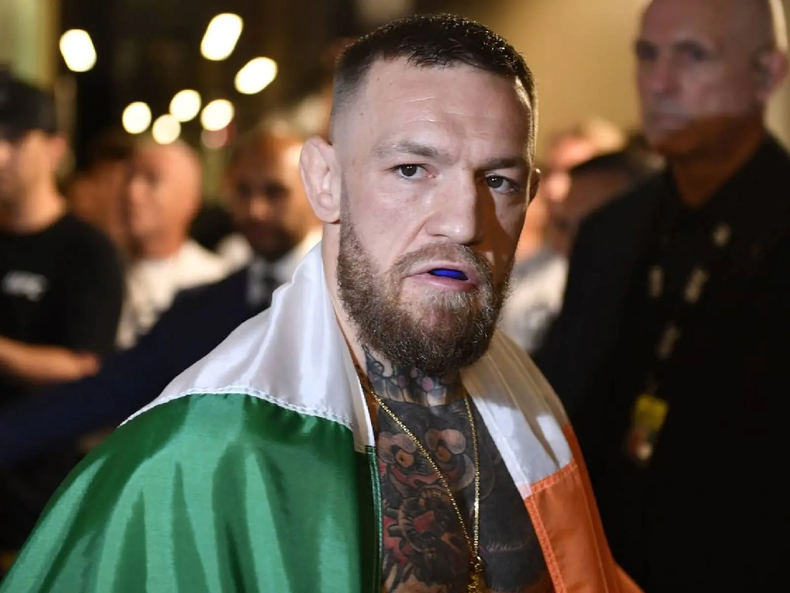 UFC 格鬥天王 Conor McGregor 歷經 3.5 小時手術，轟對手贏得比賽是「不合法的勝利」！