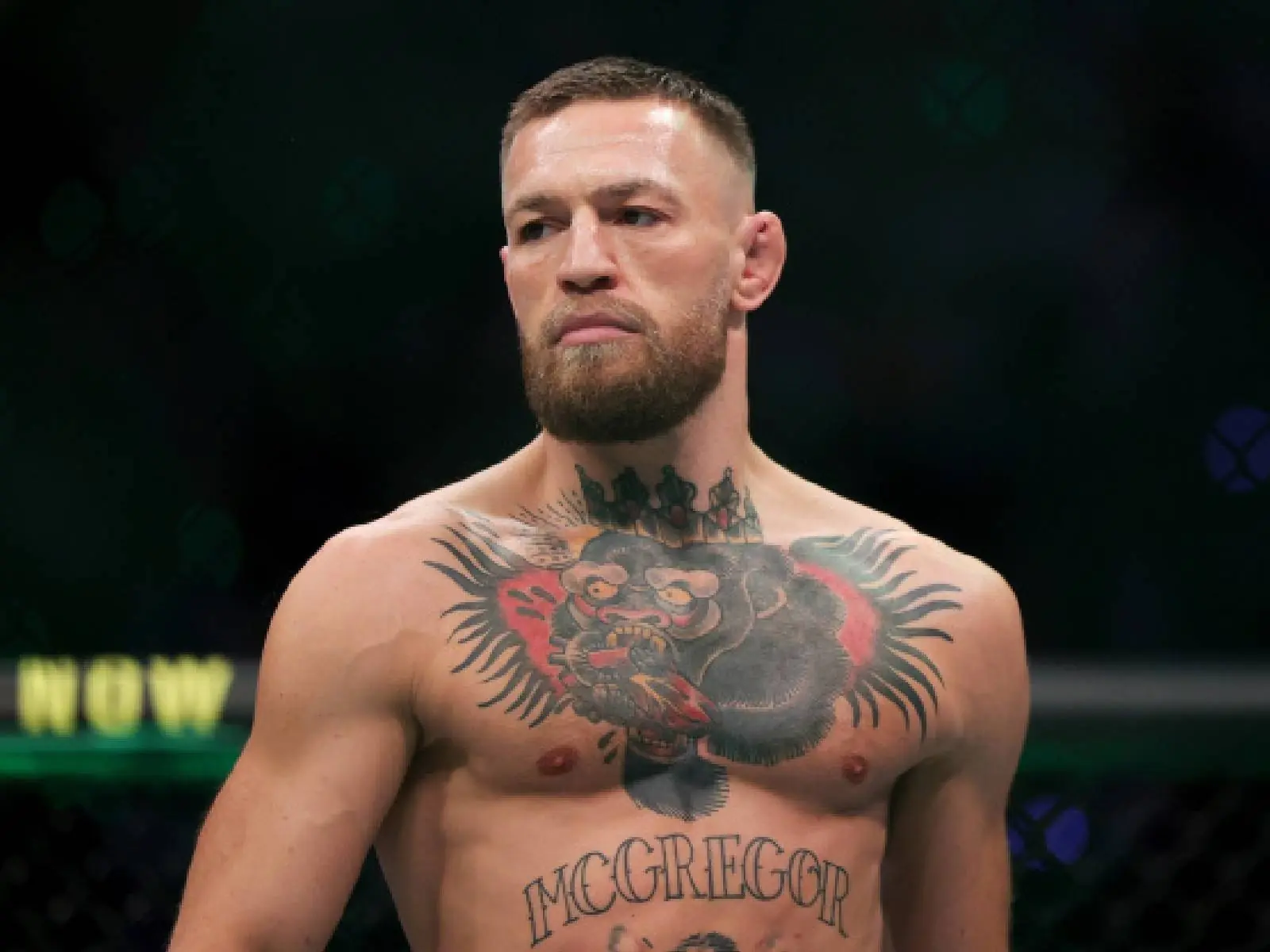 「UFC 格鬥天王」Conor McGregor 出院親曝賽前就有多處骨折，白大拿、UFC 都知道真相！