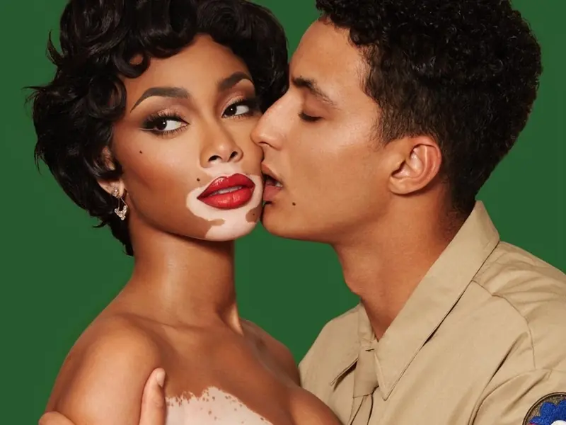 NBA／Kyle Kuzma 與白斑症名模 Winnie Harlow 分手！離開 LA 真的差這麼多！？