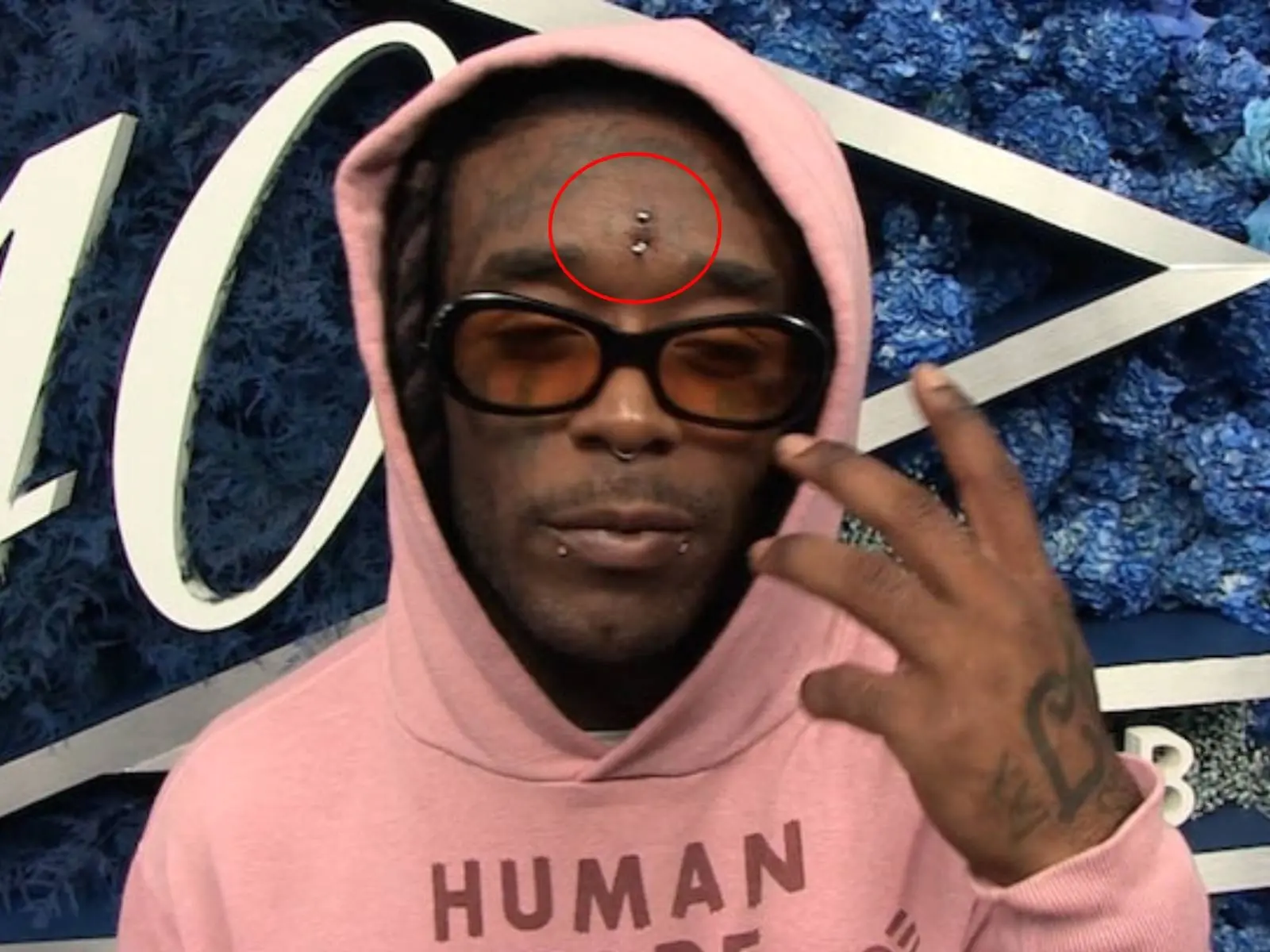 美國饒舌歌手 Lil Uzi Vert「6.7 億天價額頭粉鑽」被人拔掉，馬上換 140 元釘子補洞！