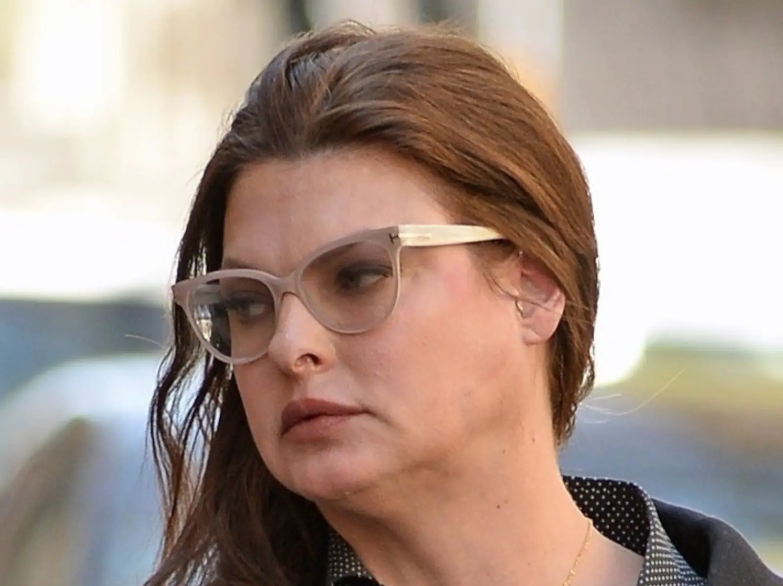 傳奇超模 Linda Evangelista 痛揭隱退原因：「我因醫美失敗而永久性毀容...」