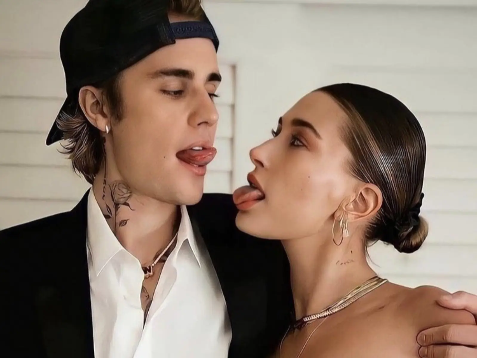 小賈老婆 Hailey Bieber 自曝因「中風症狀」送醫入院治療：「我的腦部有一個小血塊⋯」