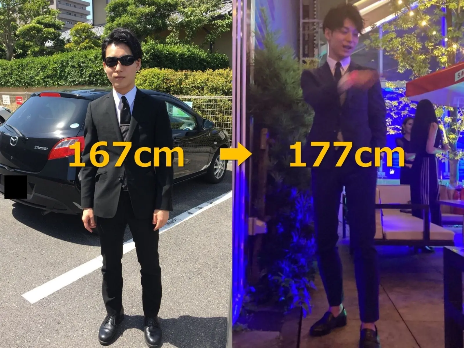 日本型男豪砸百萬做「骨骼延長手術」，167 公分圓夢抽高 10 公分成真正「高富帥」!