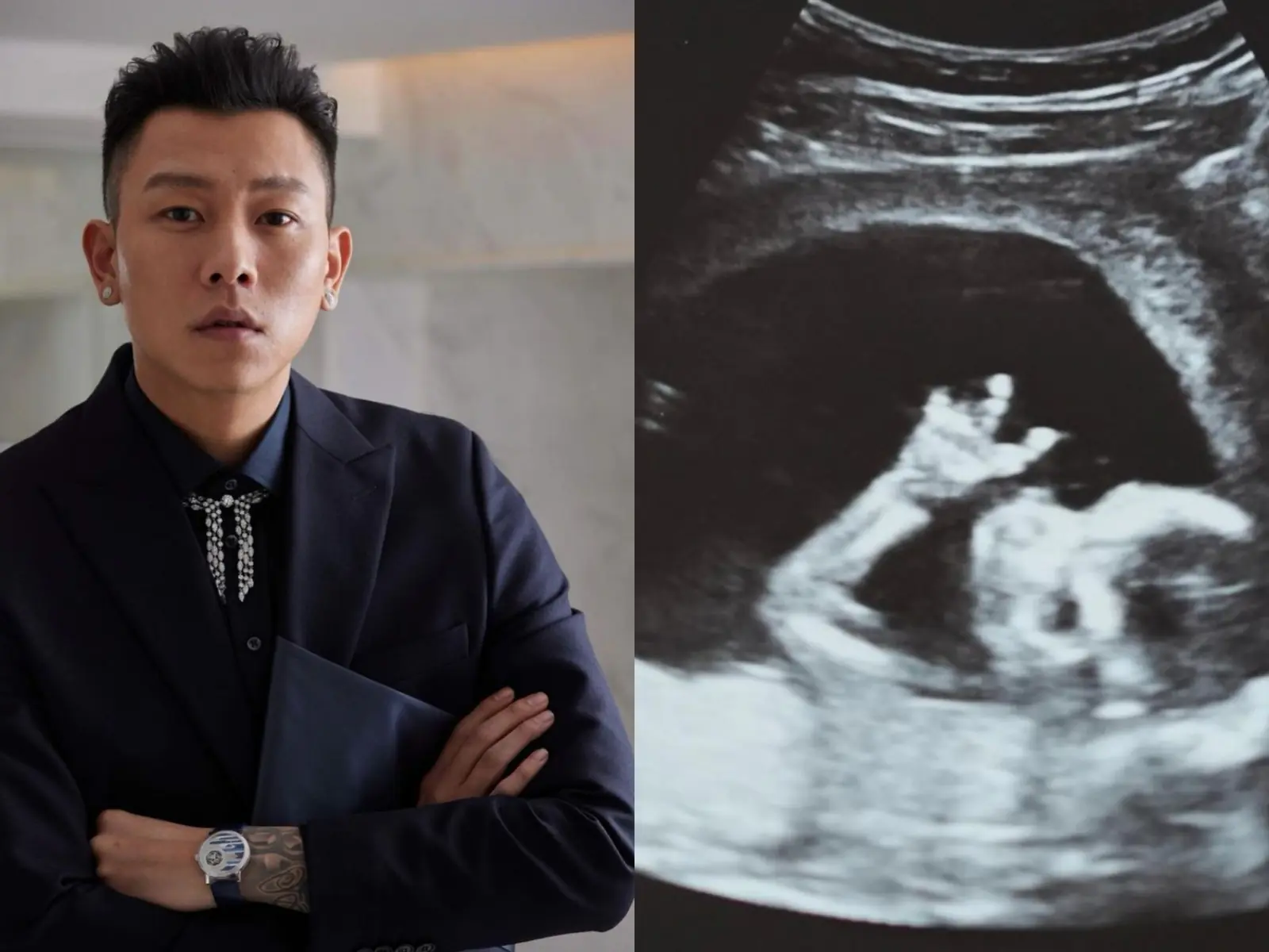 頑童瘦子升格當爸了！IG 搶曬嬰兒超音波照甜喊：「Say what’s up to the world, kid！」