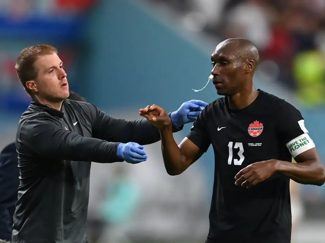 卡達世界盃／加拿大足球員 Atiba Hutchinson  用「衛生棉條」止住鼻血，引發全球球迷驚呼！