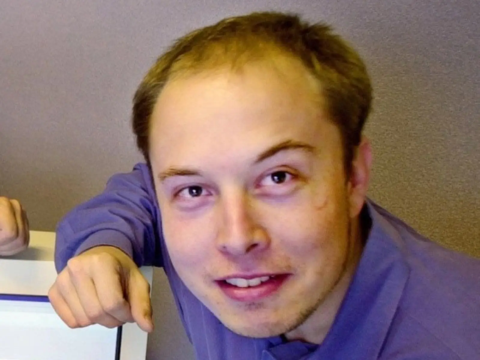 馬斯克 Elon Musk 遭爆瘋狂砸錢整形，連這裡也整引網酸：「果然有錢就是任性！」