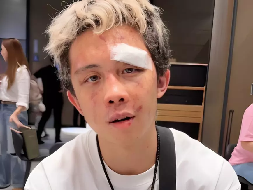 《拳願之星》孫安佐遭「台中燒打雞」韓森 K 爆滿臉濺血！坦言：「我才沒有講幹話！」