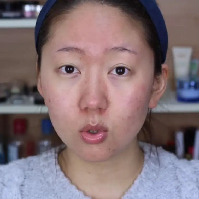 韓國驚人化妝術居然比整形還厲害！爛臉女孩變身嬰兒肌膚原來是靠...