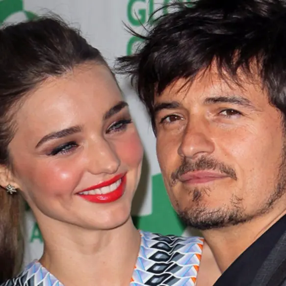 Miranda Kerr 開腔談及與 Orlando Bloom 分開的感受：那時真的很難受⋯⋯