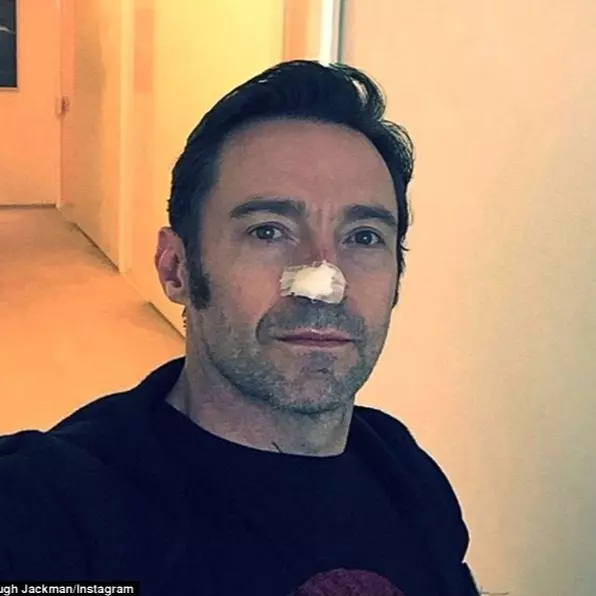 心疼金鋼狼！48 歲休傑克曼皮膚癌轉移再度復發　六度開刀向粉絲報平安！