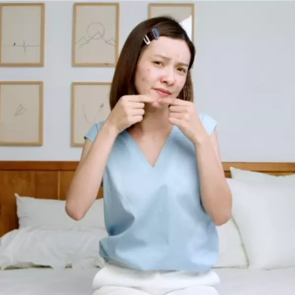 痘痘、粉刺這樣做反而會更嚴重？不用慌！潮模李柔的私房解法大公開，原來有它們就行了！