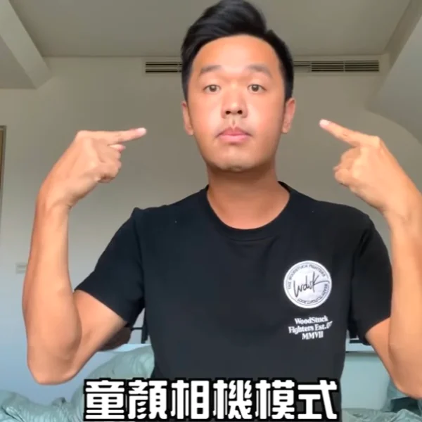 撞臉童顏相機！戽斗香蕉做「正顎手術」近況曝光　網驚：變短短的芭蕉了！
